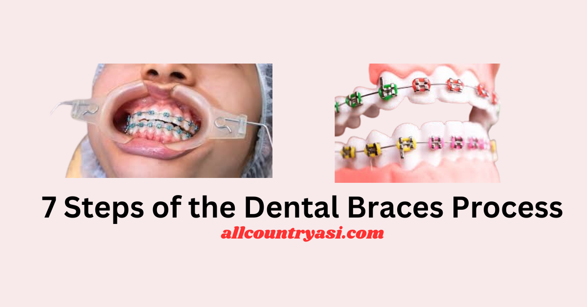 7 Steps of the Dental Braces Process