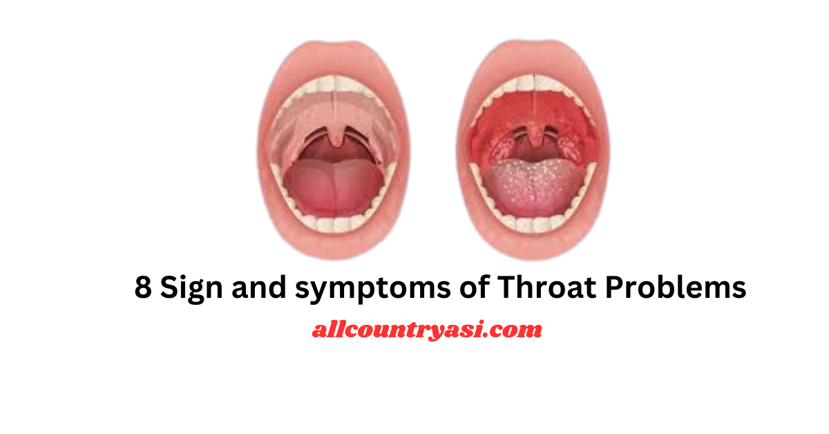 8 Sign and symptoms of Throat Problems 2024