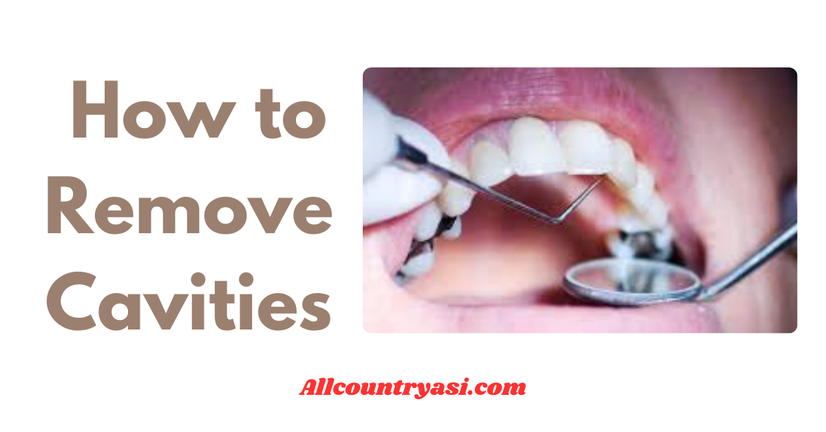 Best Way How to Remove Cavities