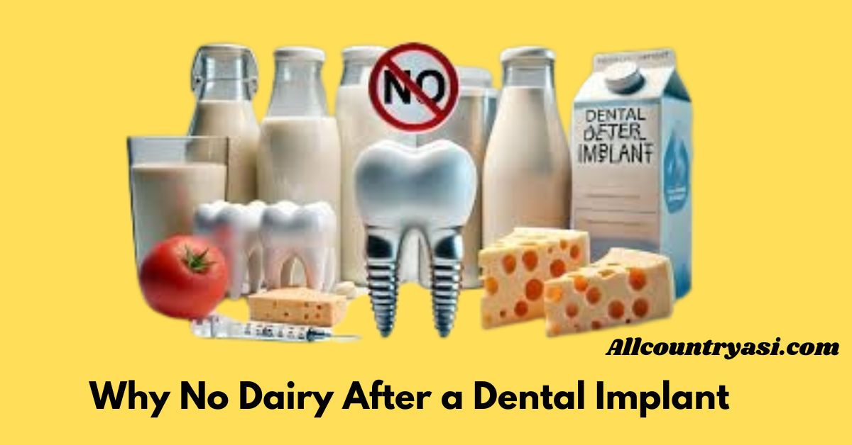 Why No Dairy After a Dental Implant