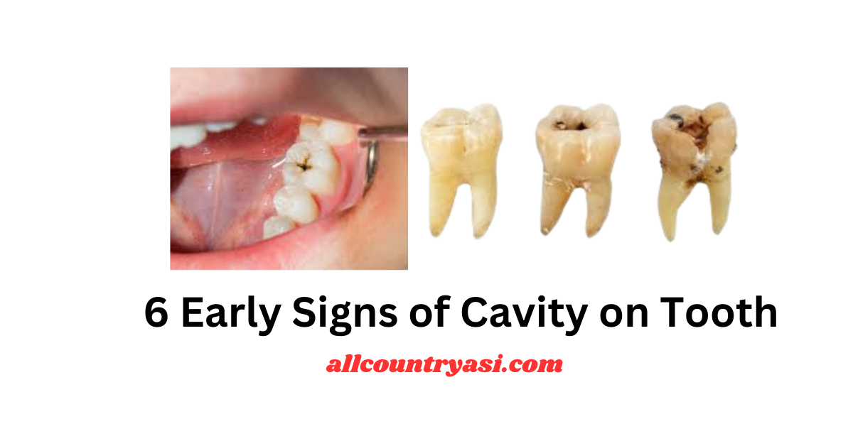 6 Early Signs of Cavity on Tooth