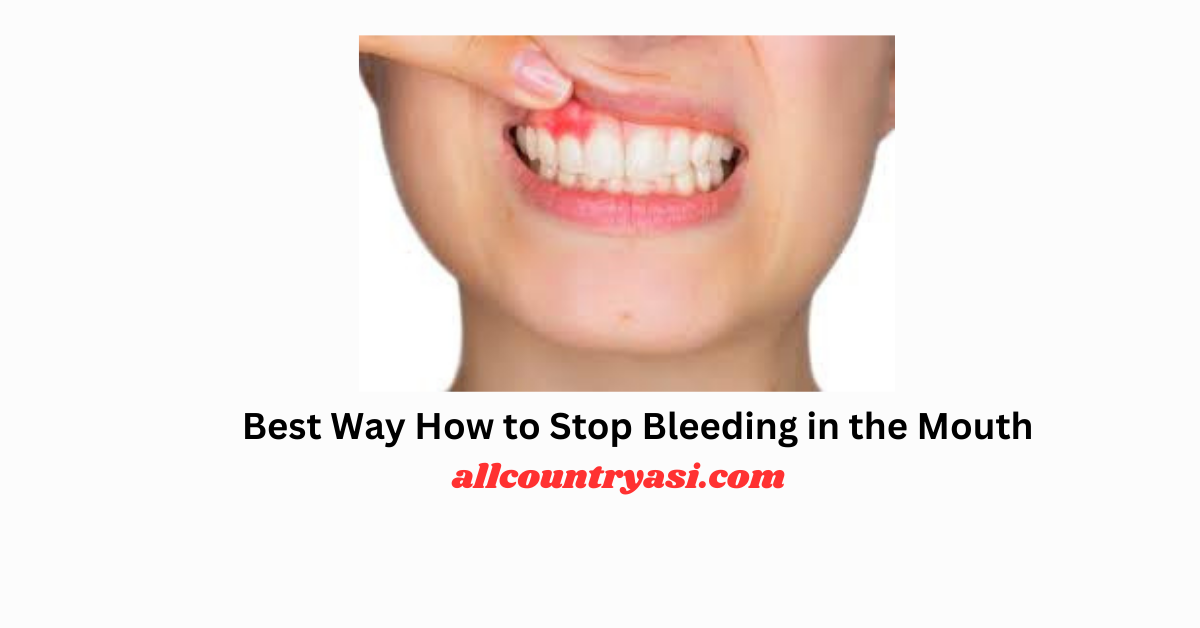 Best Way How to Stop Bleeding in the Mouth