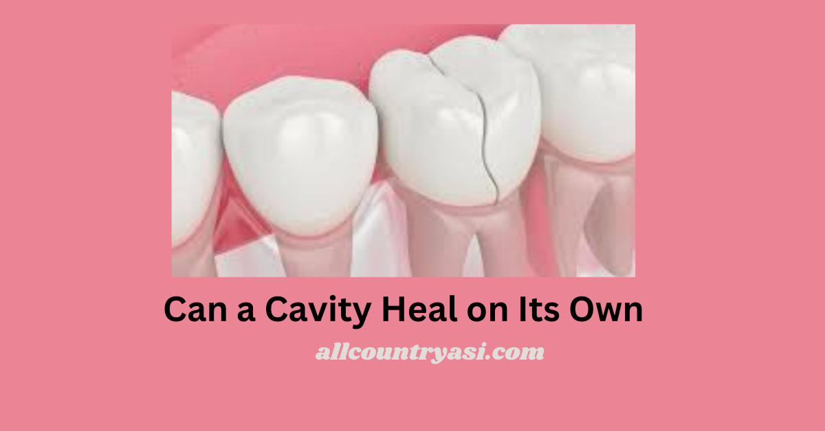 Can a Cavity Heal on Its Own