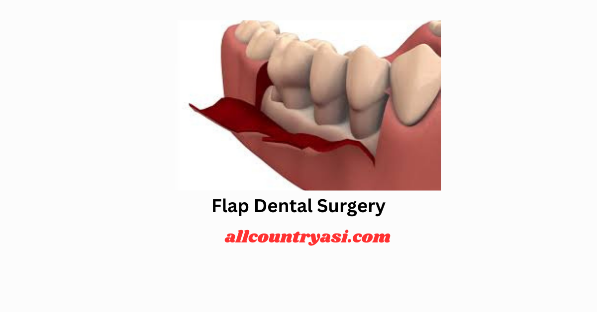 Flap dental surgery